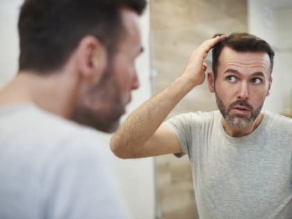 Ученые выявили новые причины облысения у мужчин