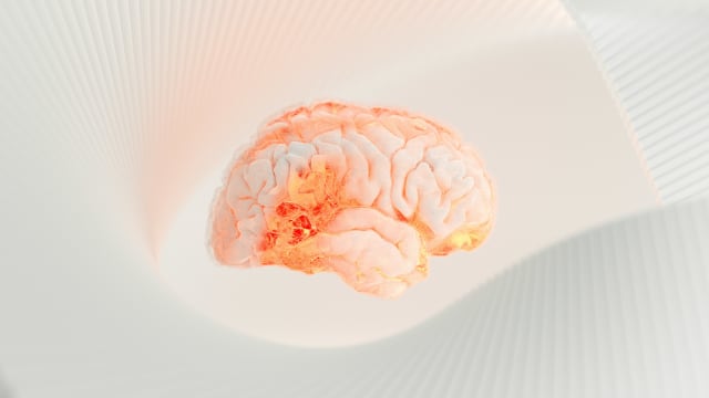 Cerebrovascular Accident (Stroke): Causes, Symptoms, Diagnosis, Treatment, Prevention, and Rehabilitation.