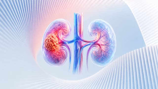 World Kidney Cancer Day 2026: Kidney Cancer, Emotional Wellbeing, Awareness, and Prevention.