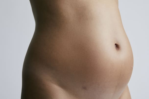 Eliane (33): «Nach der Notoperation wurde mir mein Körper fremd»