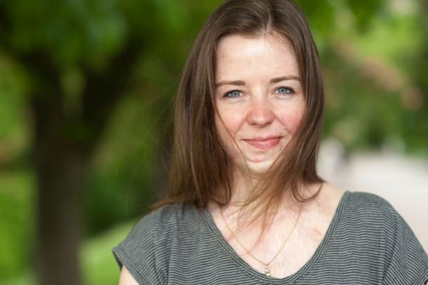 Mit Brandnarben im Gesicht zu leben?