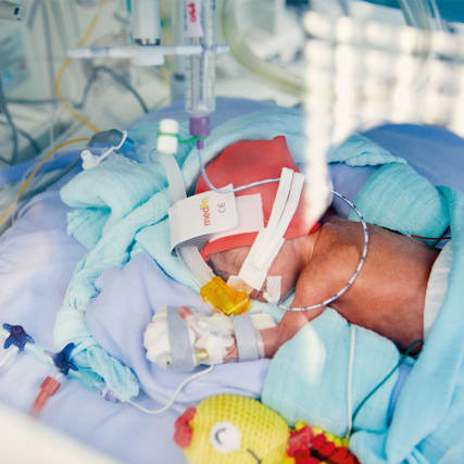 Viel zu früh auf der Welt: Ein Besuch auf der Frühchenstation