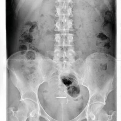 Das Eigenleben meiner Kupferspirale