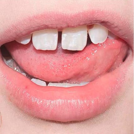 Countdown: Monica Pozzi