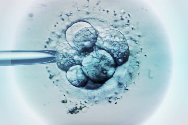 IVF, ICSI oder Leihmutterschaft – ein Überblick