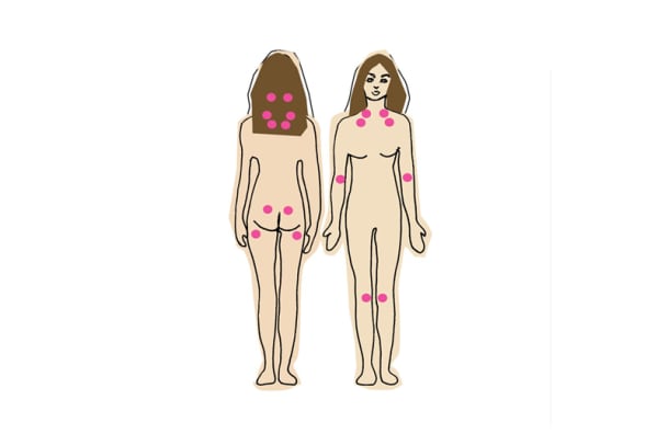 Chronische Schmerzen: Diagnose Fibromyalgie