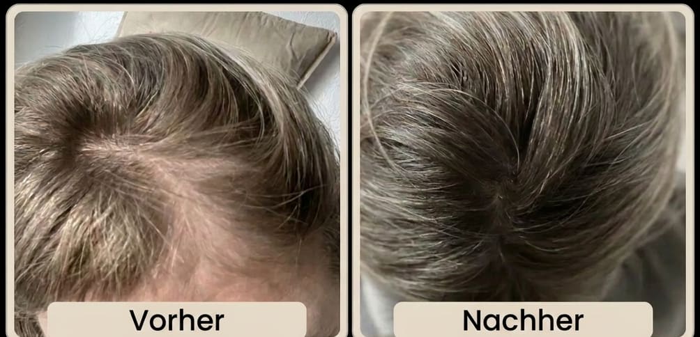 Vorher/Nachher Martina (54 Jahre) – dichteres Haar nach 3 Monaten Glow25