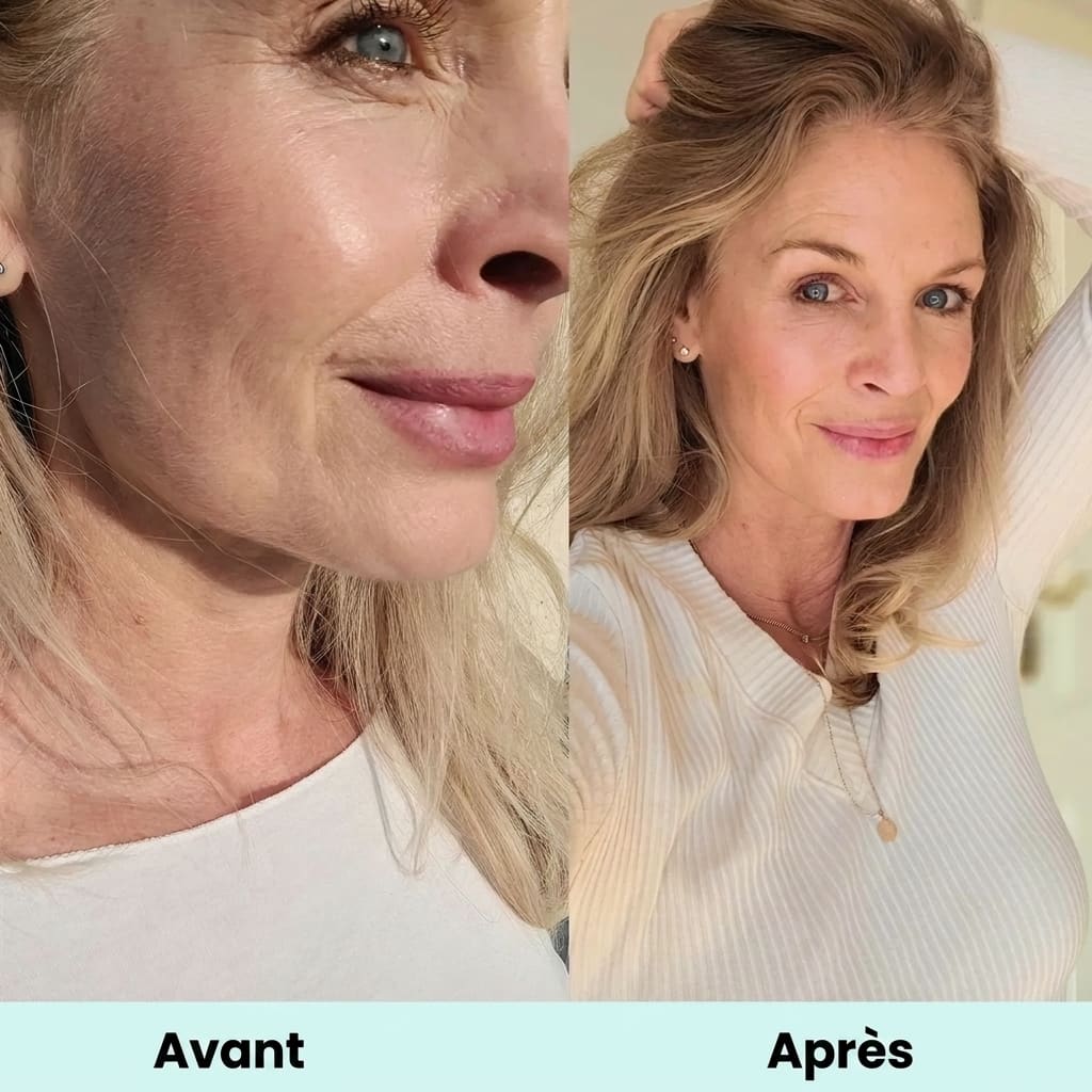 Avant/Après après 8 semaines de Collagen Intensive de Glow25