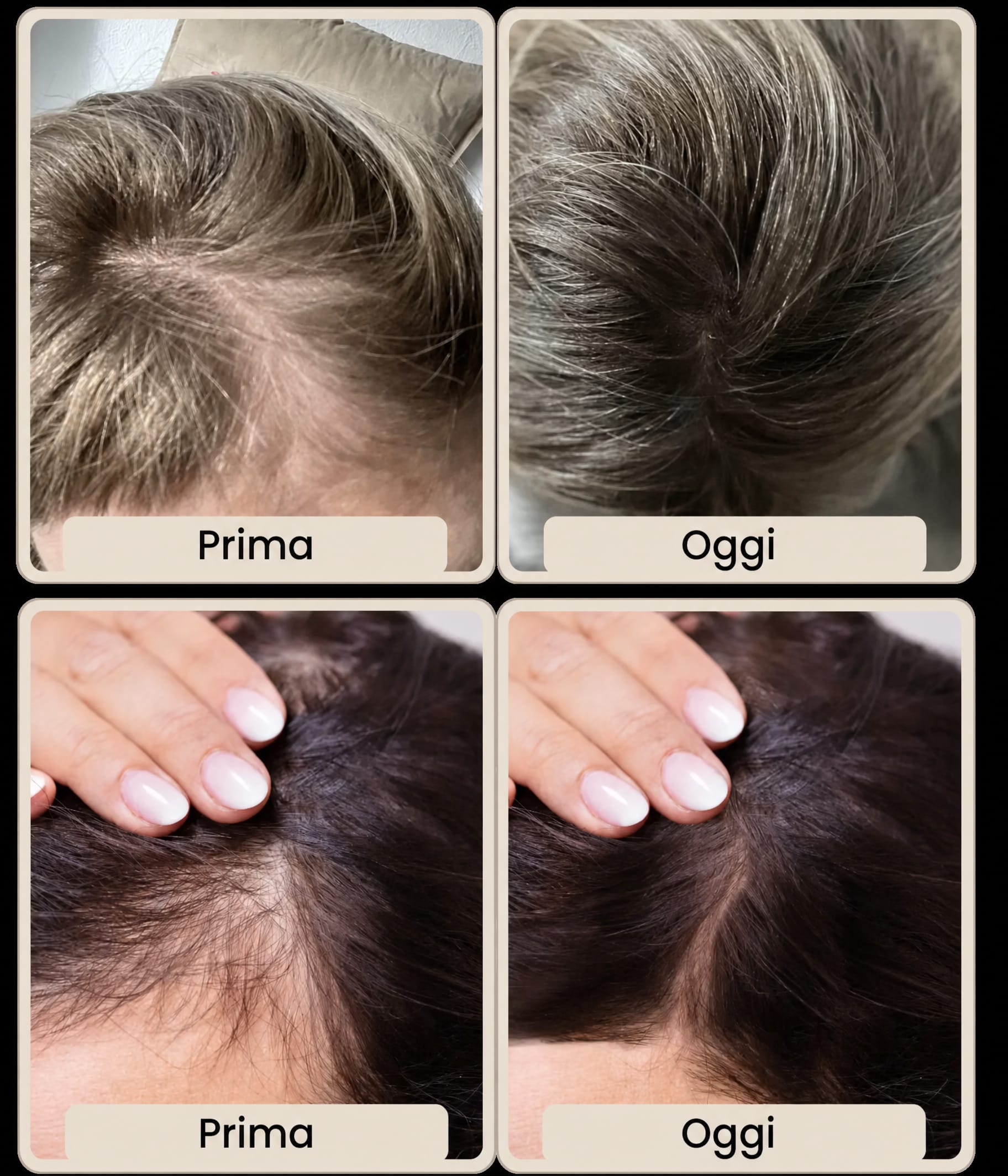 Prima/Dopo Cristina (54 anni) — capelli più folti dopo 3 mesi di Glow25