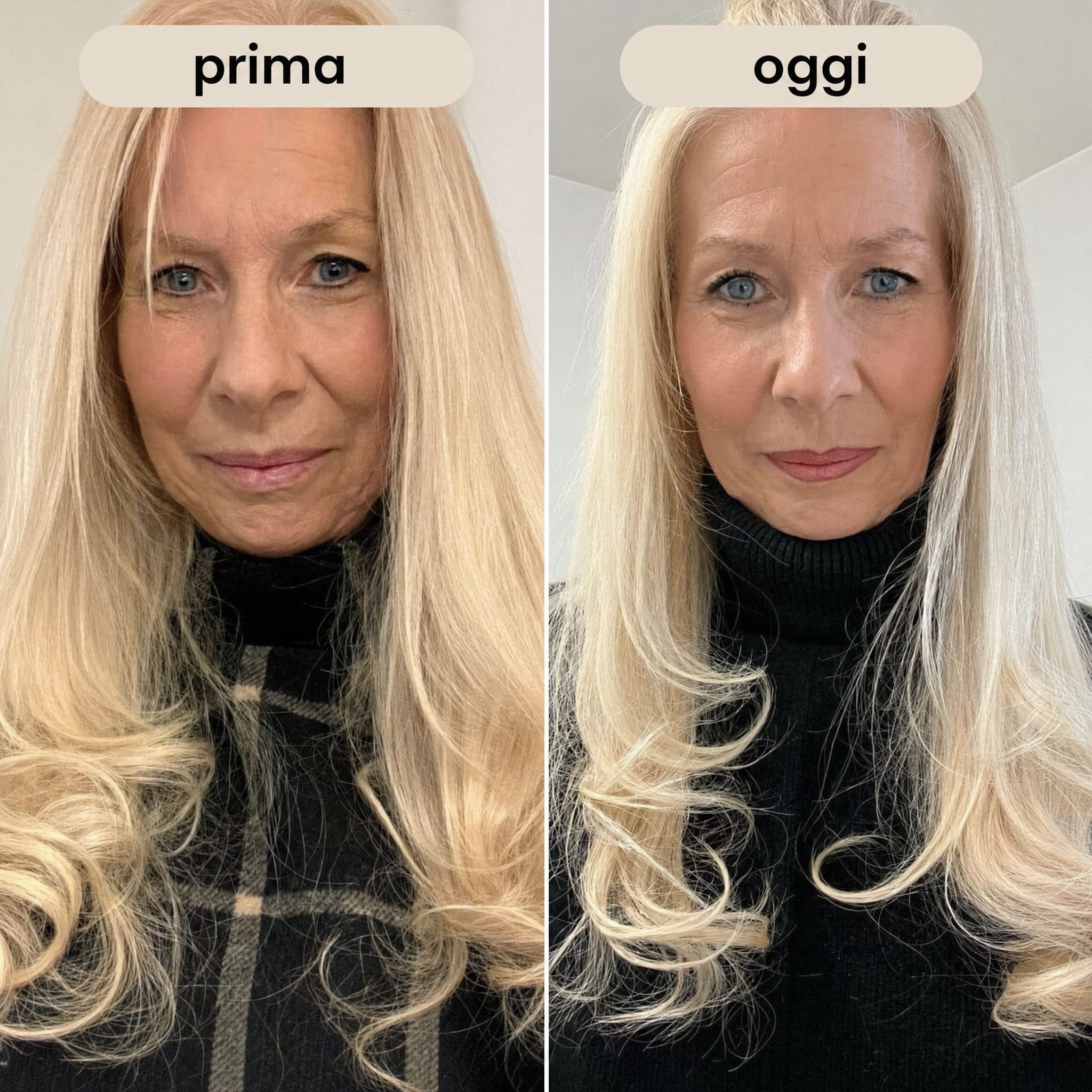 Prima/Dopo Liliana (61 anni) — Collagen Intensive di Glow25