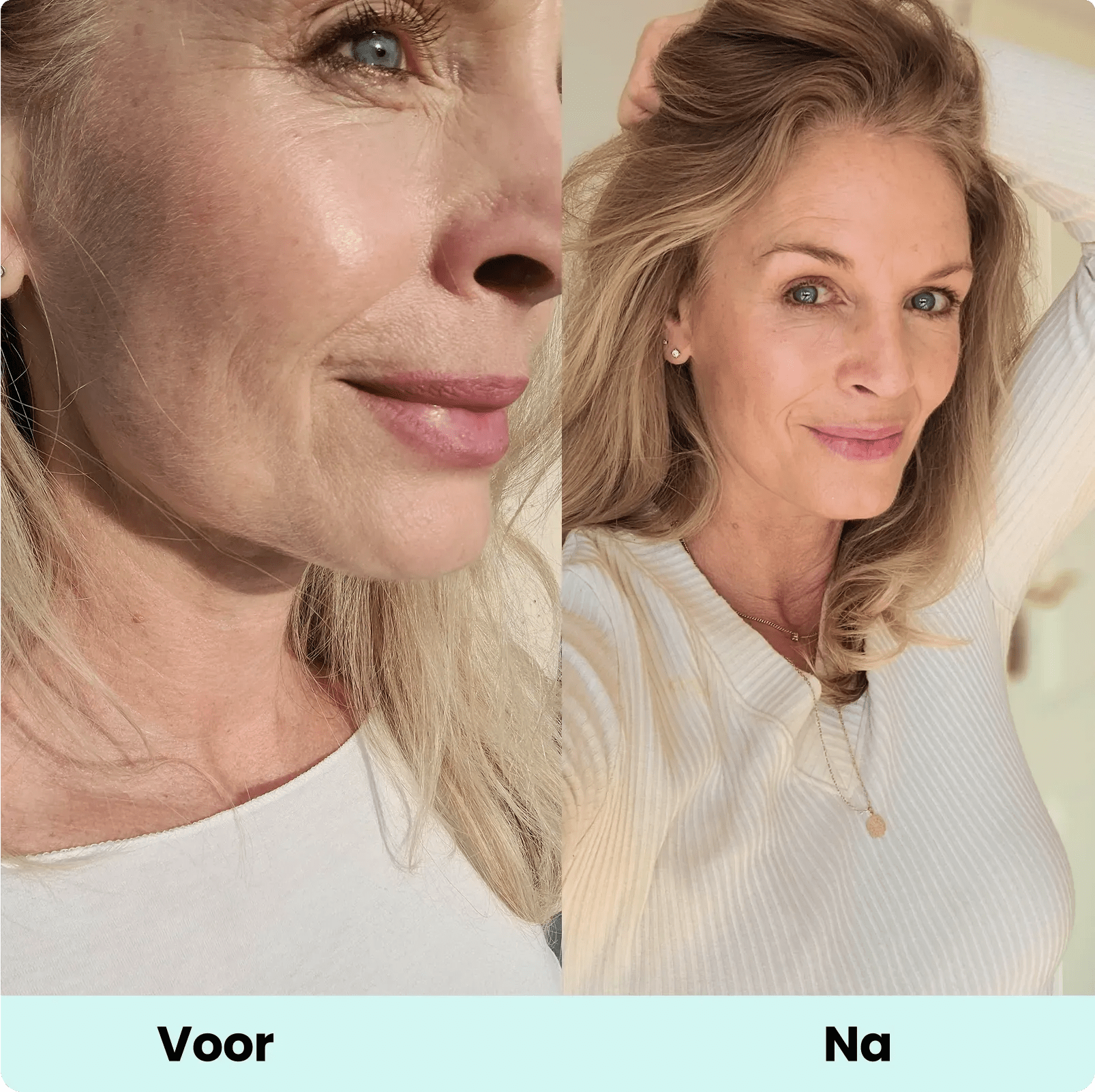 Voor/Na na 8 weken Collagen Intensive van Glow25