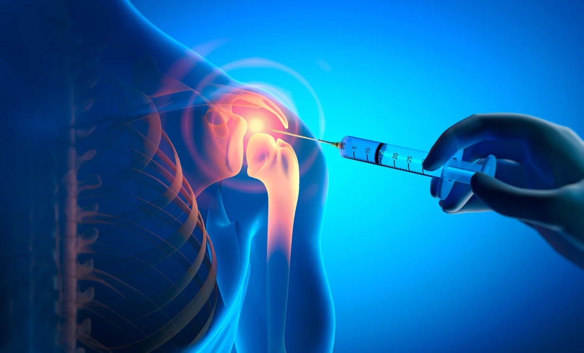 Shoulder Pain