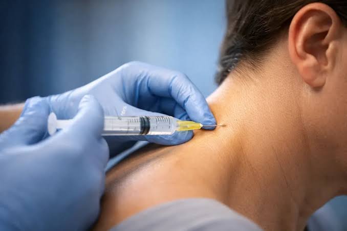 Nerve Block