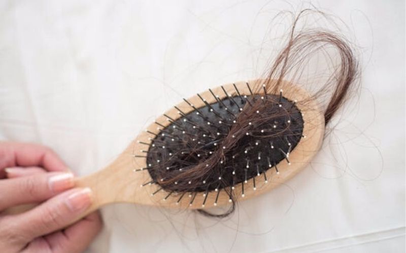 5 Penyebab Rambut Rontok yang Jarang Diketahui