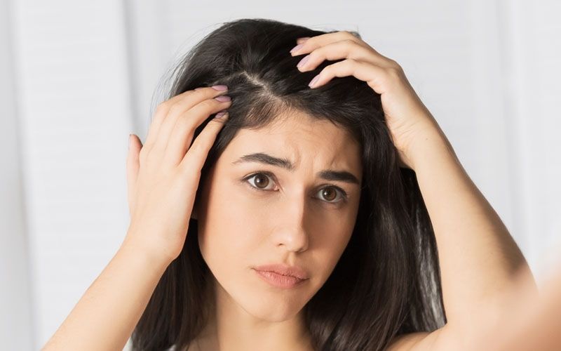 Hilangkan Ketombe dengan Beragam Haircare Alami dari Minyak Zaitun