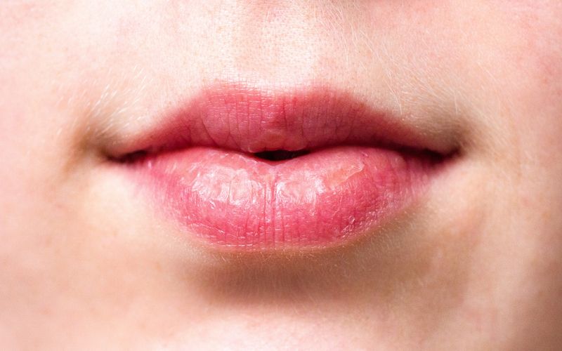 Say No To Bibir Kering, Inilah 5 Cara Atasi Bibir Kering Saat Puasa!