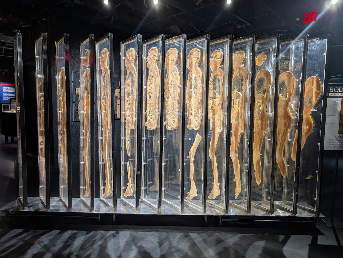 Bodies Human Museum