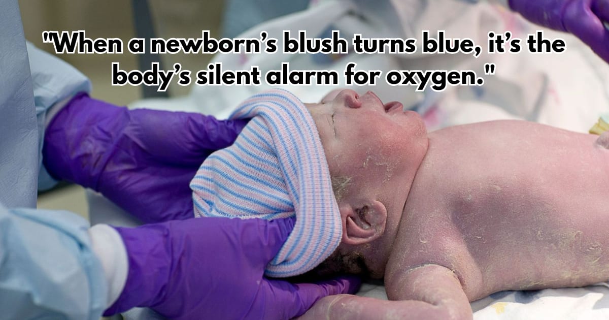 Blue Baby Syndrome: What the Condition Indicates & Key Symptoms