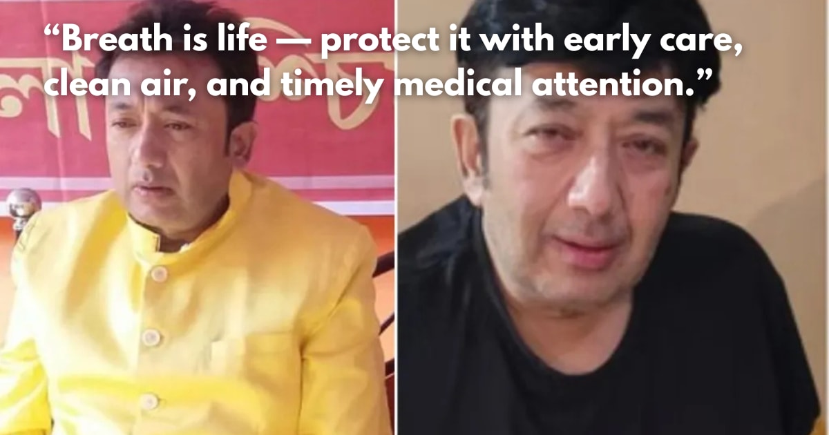 Actor Joy Banerjee's Death: The Role of COPD & Pneumonia