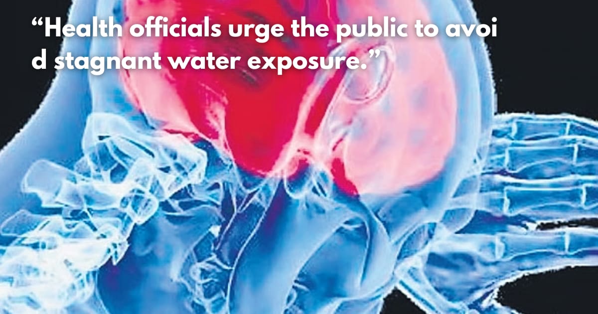 Amoebic Meningoencephalitis: Why Treatment is Delayed & What to Know