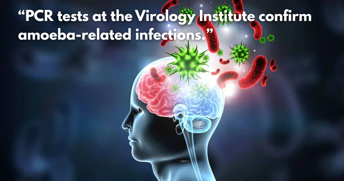 Amoebic Meningoencephalitis: Why Treatment is Delayed & What to Know
