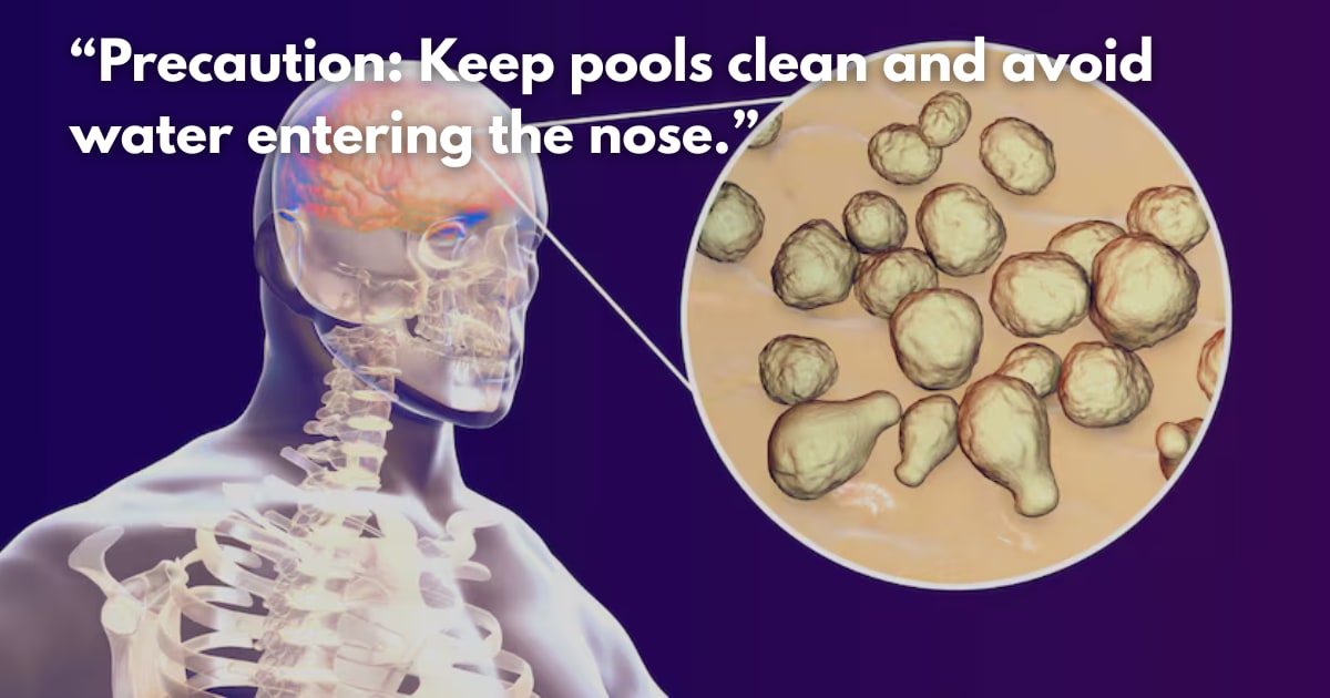 Amoebic Meningoencephalitis: Why Treatment is Delayed & What to Know