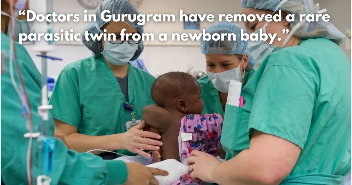 Doctors Remove Parasitic Twin from Newborn in Rare Surgery