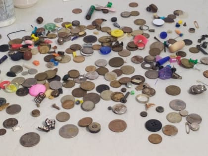 В&nbsp;Красноярске 348 детей проглотили опасные предметы и&nbsp;попали к&nbsp;хирургам