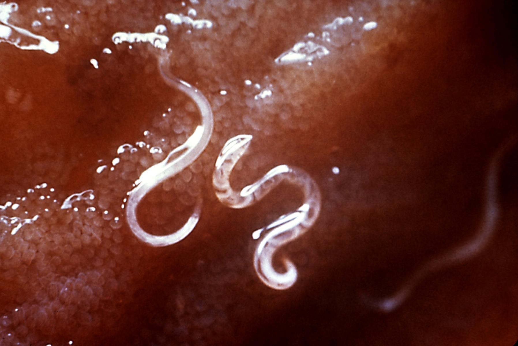 Hookworm 1