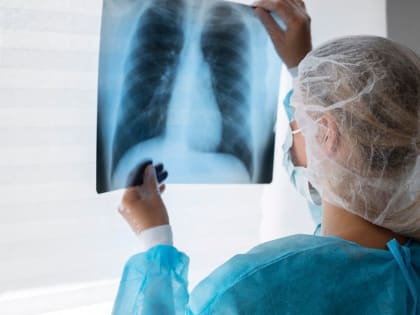 Больной туберкулезом житель Марпосадского округа отправлен на принудительное лечение