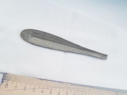 Врачи эндоскопического отделения ГКБ №1 извлекли из желудка мужчины фрагмент столовой ложки