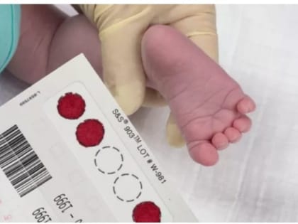 Всем новорождённым Чувашии проводят неонатальный скрининг на 36 заболеваний