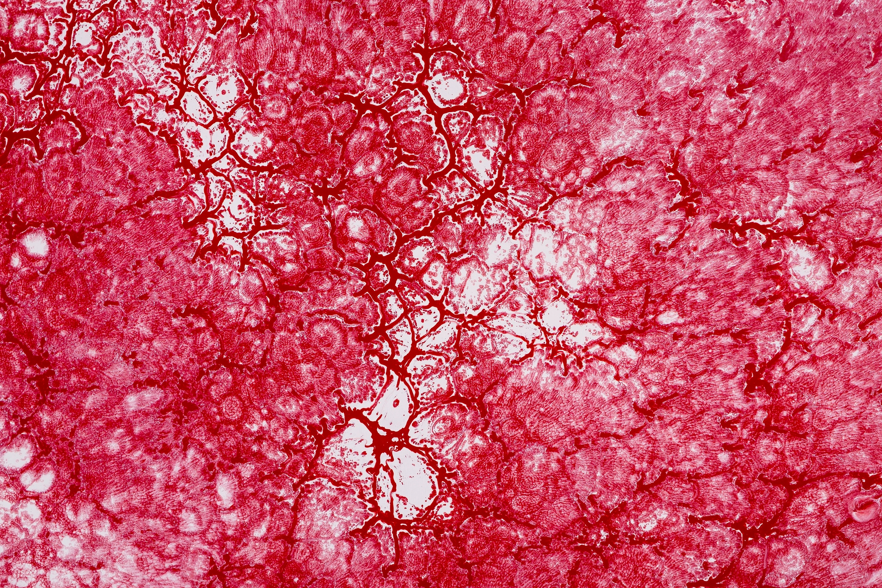 River IV — vista 1