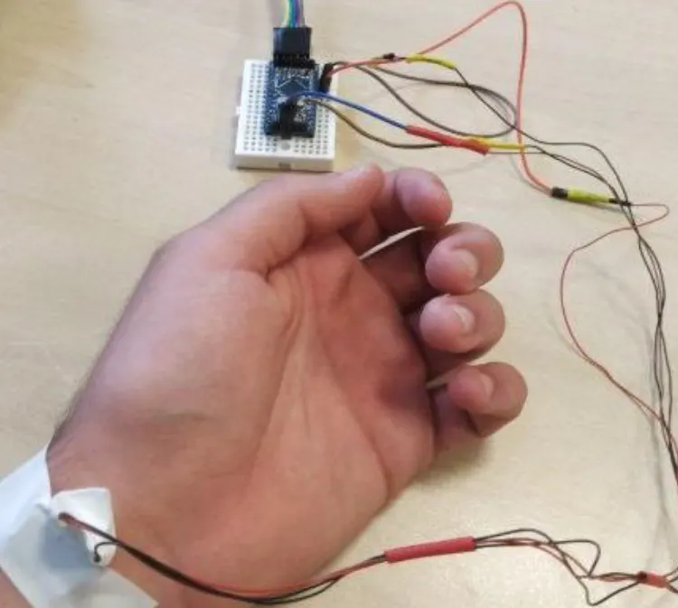  iLancet™ Autonomous Smart Bracelet