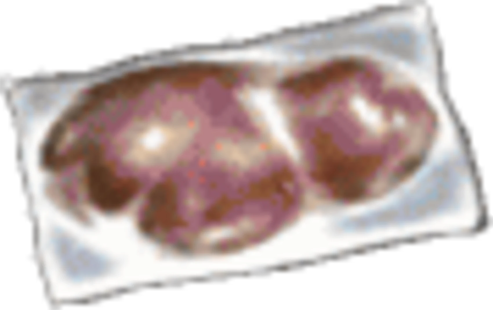 Silent Hill 3 Items Pork Liver