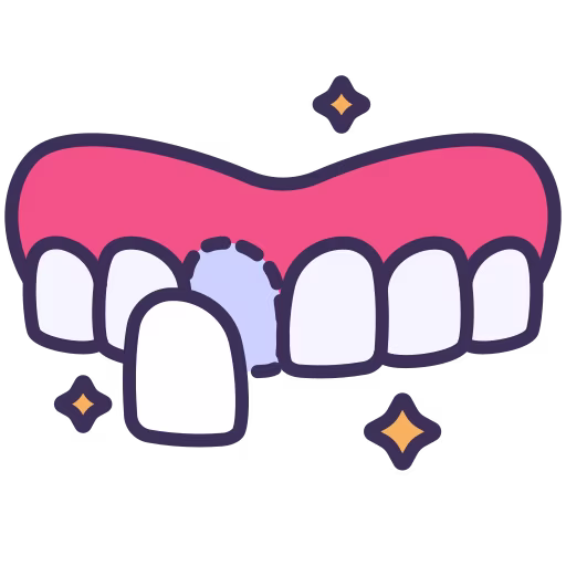 Carillas dentales