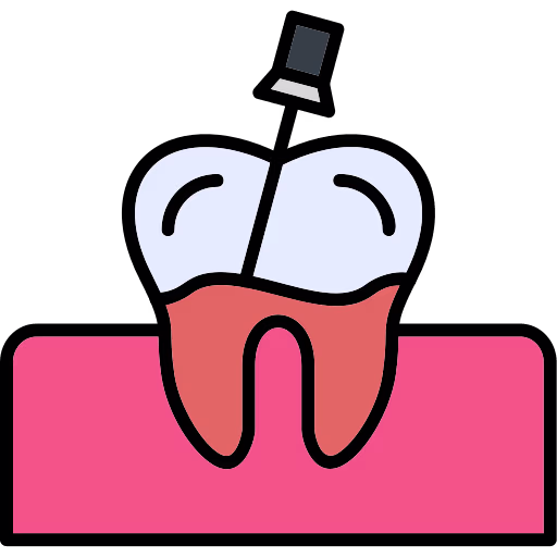 Endodoncias