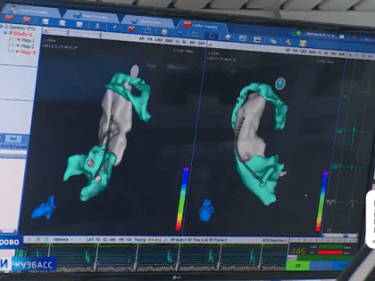 Кемеровские аритмологи первыми в России провели операцию без рентгенконтроля
