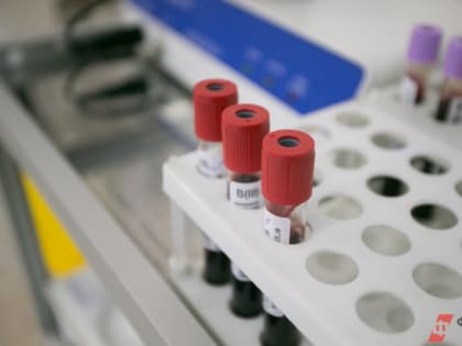 Снижение числа ВИЧ-инфицированных в Кузбассе