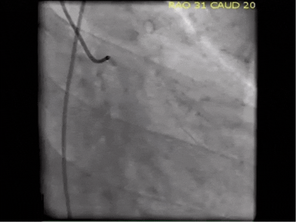 Sample Angiogram Big-Matrix Lab