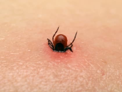 В Ейском районе зарегистрировано 53 случая присасывания клещей