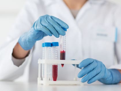 Будет густой: продукты, которые естественным образом сгущают кровь