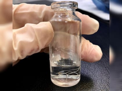 Опасный укус комара: в Краснодаре из тела женщины достали червя-паразита