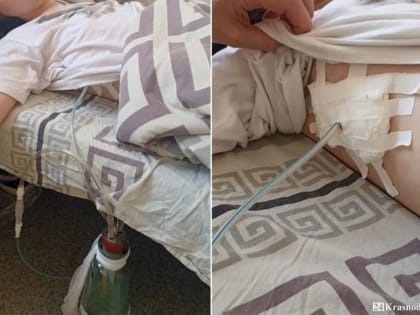 Иглой прокололи легкое?