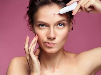 Как избавиться от прыщей на лице за 1 час: делайте это в любом возрасте