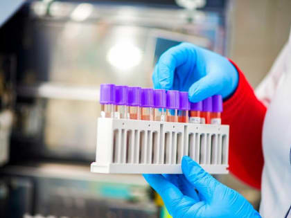 В России выявили случаи микроплазменной инфекции, вспышка которой произошла в Китае