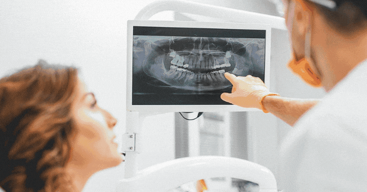 Dentist Lead Gen Funnel | NEW 2022! | *The BEST Option* HIGH CONVERSIONS