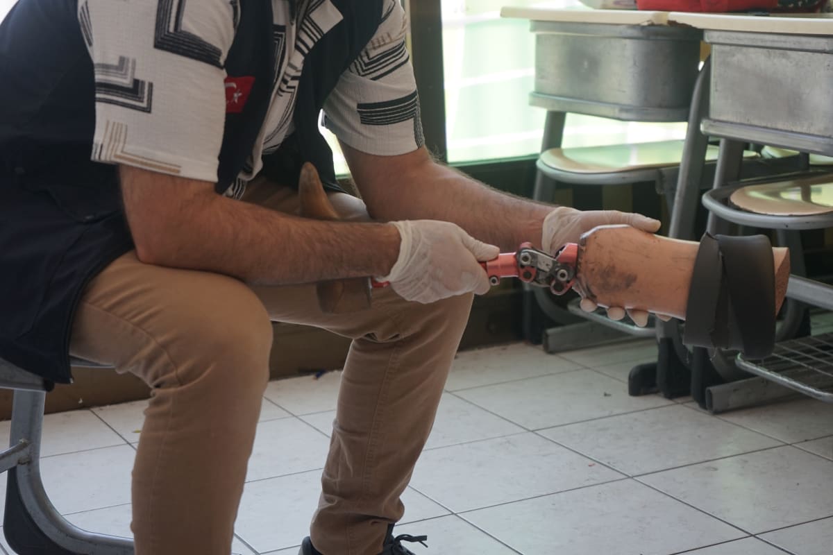 Prosthetics & Physical Therapy 2