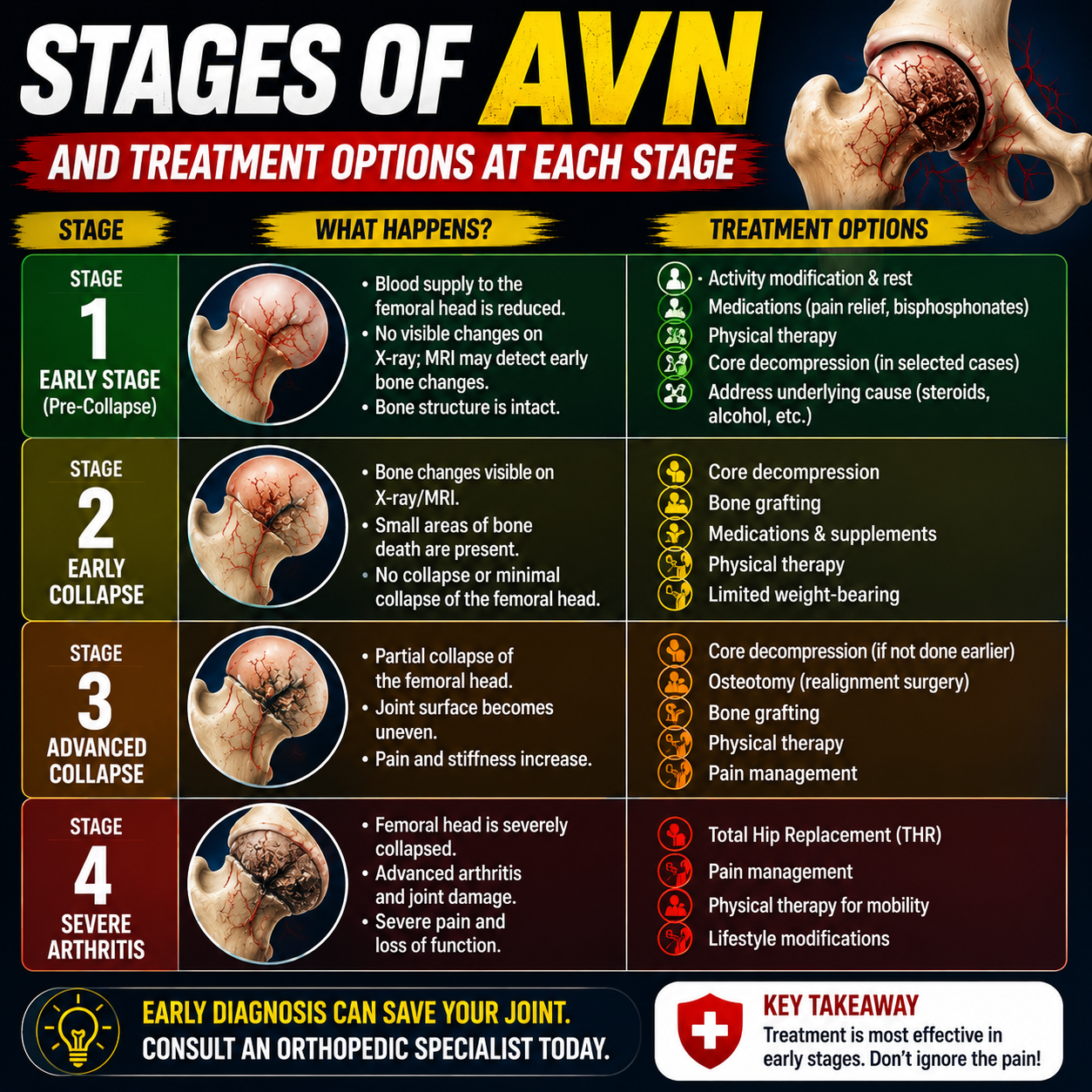 Stages of AVN and Treatment Options at Each Stage