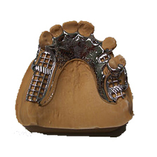 Permanent Dentures: Comfort, Confidence and a Natural Smile